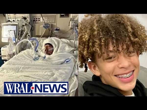 'Unrecognizable': Boy burned over 76% of his body after dangerous TikTok challenge