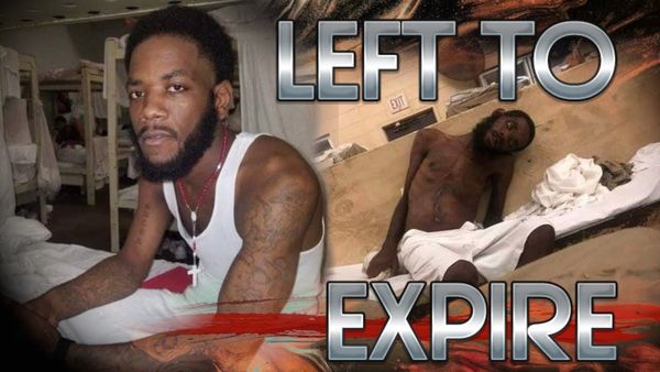 Frightening photos of Alabama prisoner go viral, but state DOC claims he won't cooperate with medical advice